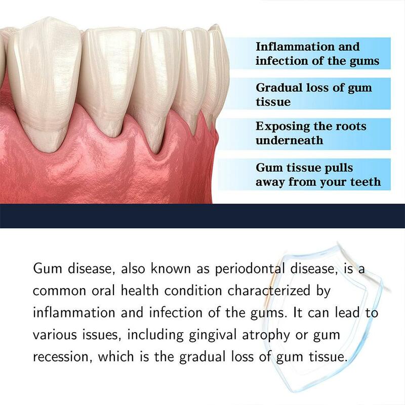 Quickly Gum Repair Drops siero alleviare il mal di denti cavità carie sbiancare i denti rimuovere le macchie di placca gialla cura dei denti 30ml