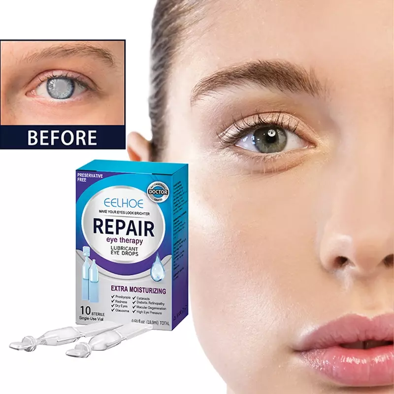 Eye Drop para melhorar a proteção da visão, aliviar a fadiga ocular, coceira seca, vermelhidão, visão loira, desconforto, solução de cuidado hidratante