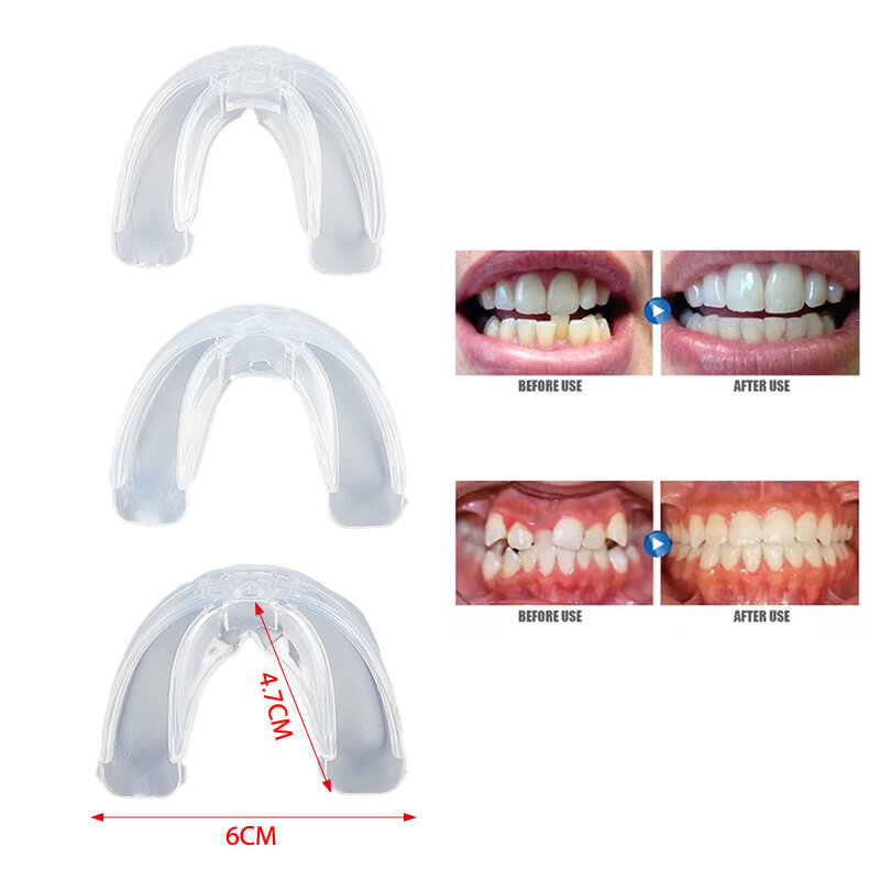 Dentes ortodônticos Corrector, Silicone Braces Retainer, Endireitar Ferramentas, Tampados Para Adultos, Ferramentas De Cuidados Dentes, 3 Fases
