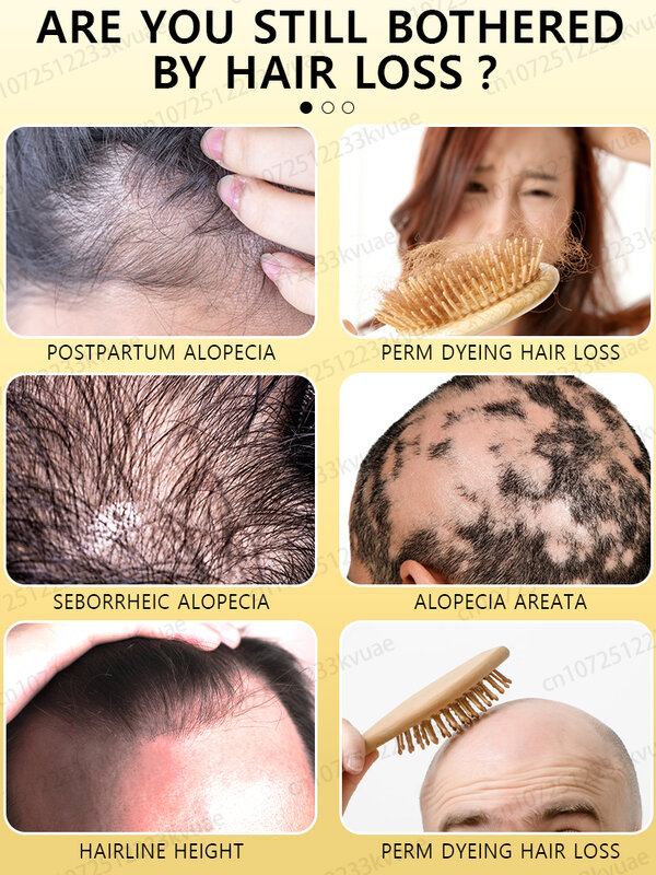 Leva apenas 7 dias para reparar a calvície. O óleo essencial para o crescimento do cabelo pode reparar eficazmente a calvície.