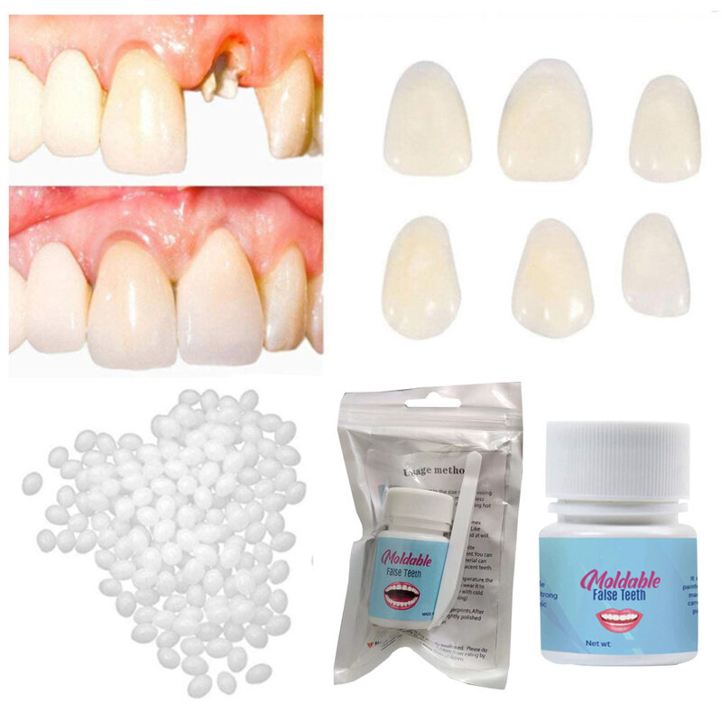 歯のための樹脂製の歯科矯正,20g,接着剤,一時的な充填,歯の修理,歯科材料,変更