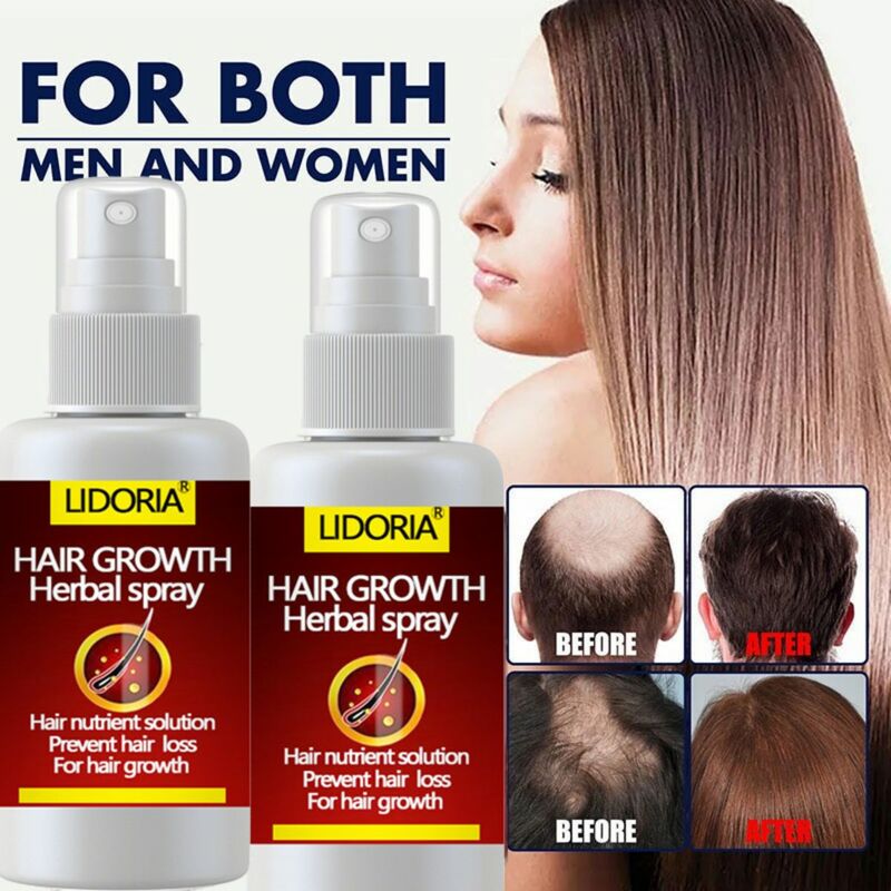Crescimento do cabelo soro spray rápido crescimento do cabelo tratamento líquido couro cabeludo folículo de cabelo anti perda de cabelo natural beleza cuidados com o cabelo