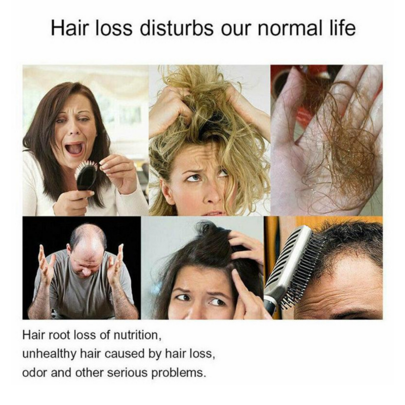 Porost włosów imbirowy szampon biotyna tłoczona na zimno odżywka przeciw utrata włosów krem do masażu pielęgnacja włosów produkty do pielęgnacji włosów