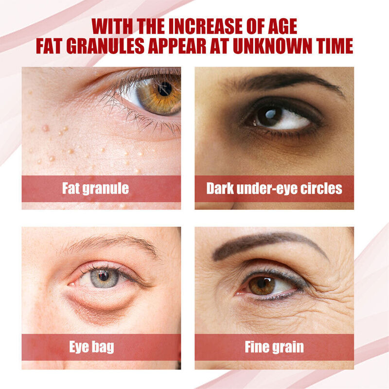 إزالة الدهون جوهر الحبوب يزيل الجسيمات حول العينين يشد يخفف الخطوط الدقيقة المصاعد جوهر العين ميليا بقعة العلاج