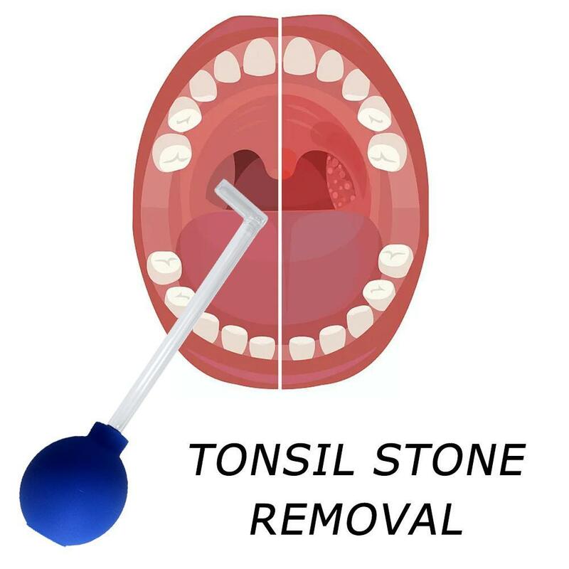 Strumento per la rimozione della pietra del Tonsil strumento per la rimozione dello stile manuale pulizia della bocca rimozione della Tonsil cura strumenti per la pietra della cera strumento per l'orecchio L0Z9