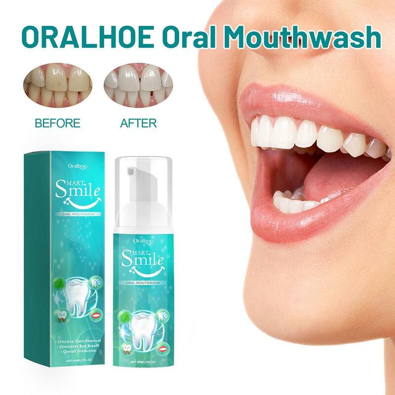 Pasta gigi pemutih busa pembersih Oral Mousse plak gigi dalam mulut kebersihan pemutih pembersih pasta gigi menghilangkan Y0i0
