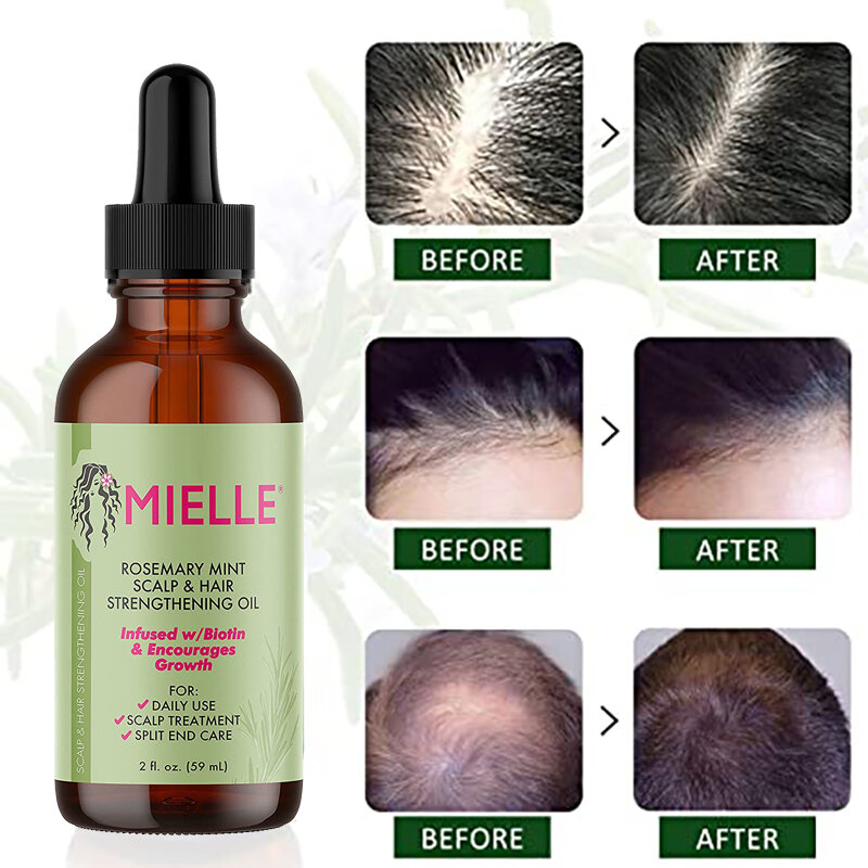 Óleo essencial para o crescimento do cabelo, Pontas divididas, Óleo essencial de umidade para fortalecimento capilar, Dry and Mielle Organics, Tratamento de hortelã