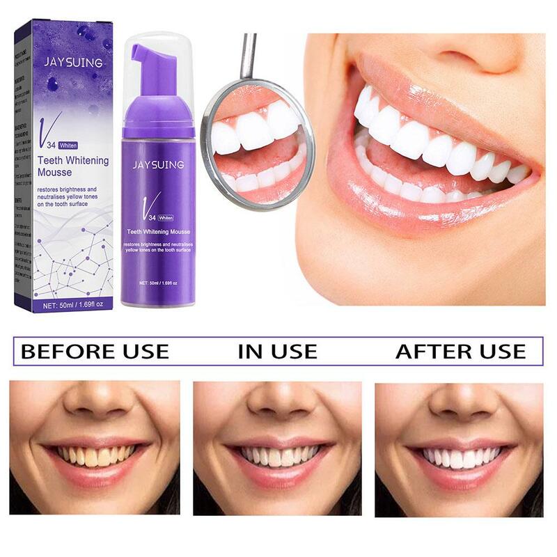 มูสยาสีฟันสูตรฟันขาวทำความสะอาดฟัน50มล. ช่วยลดคราบมูสเพื่อสุขอนามัยและการฟอกสีฟันใหม่