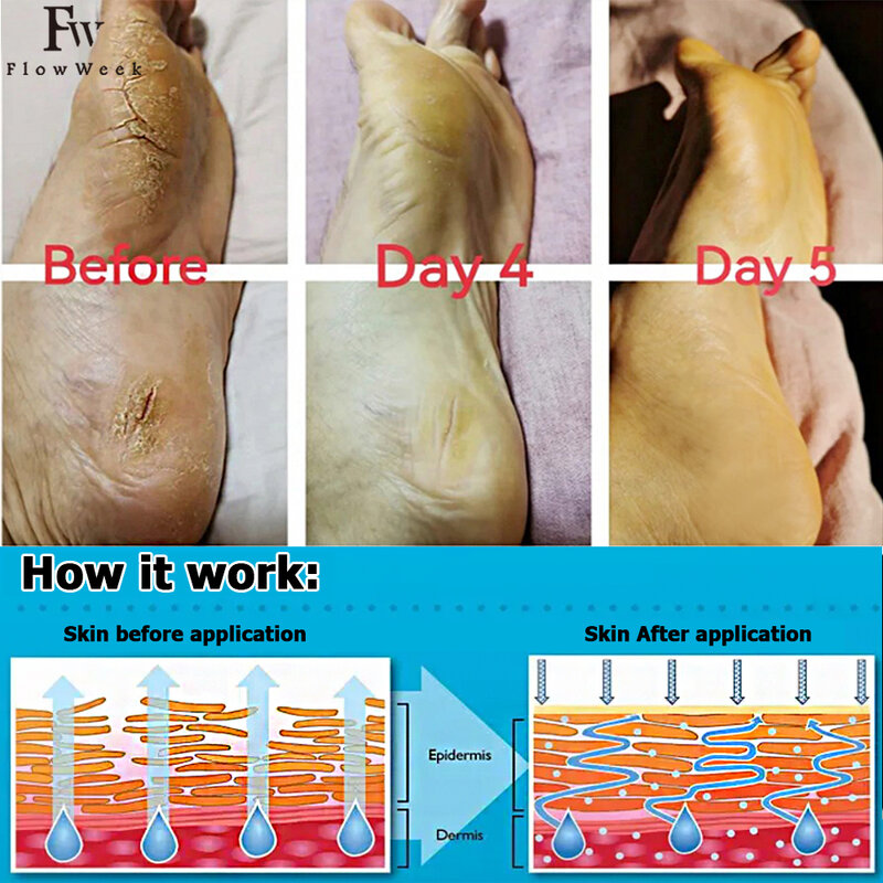 FlowWeek Urea Cream 40% plus acido salicilico 2%, crema per i piedi, adatta per riparare tacchi secchi e screpolati, piedi, ginocchia, mani e