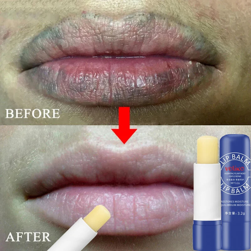 Lip Balm Remove Dark Lighten Melanin Lip Mask Fade Lip Line Brighten Exfoliating Moisturize Dead Skin Repair Lip Care Products