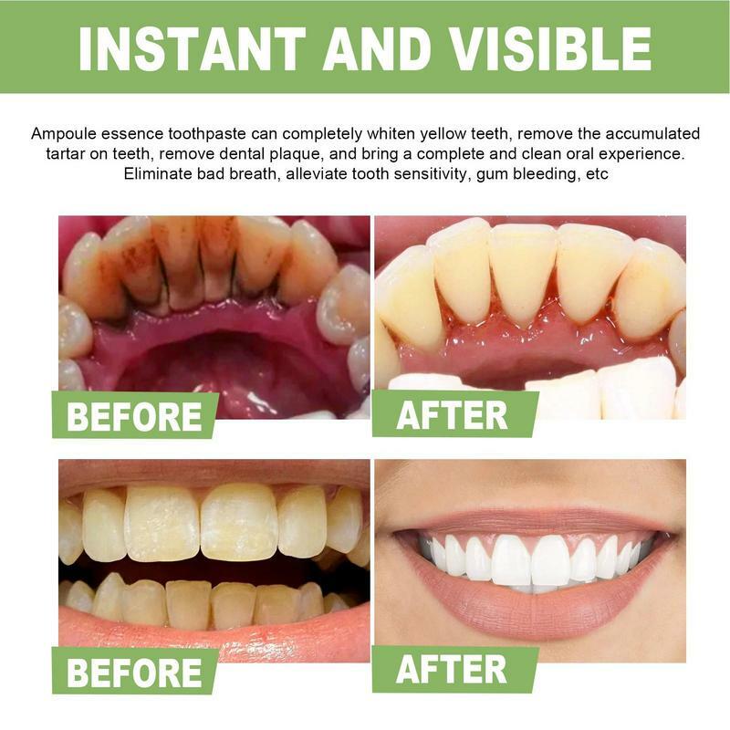 10 Pcs Natural Mint Flavor Teeth Whitening Essence Oral Care Effective Remove Stains Teeth Cleaning Serum Ampoule Toothpaste