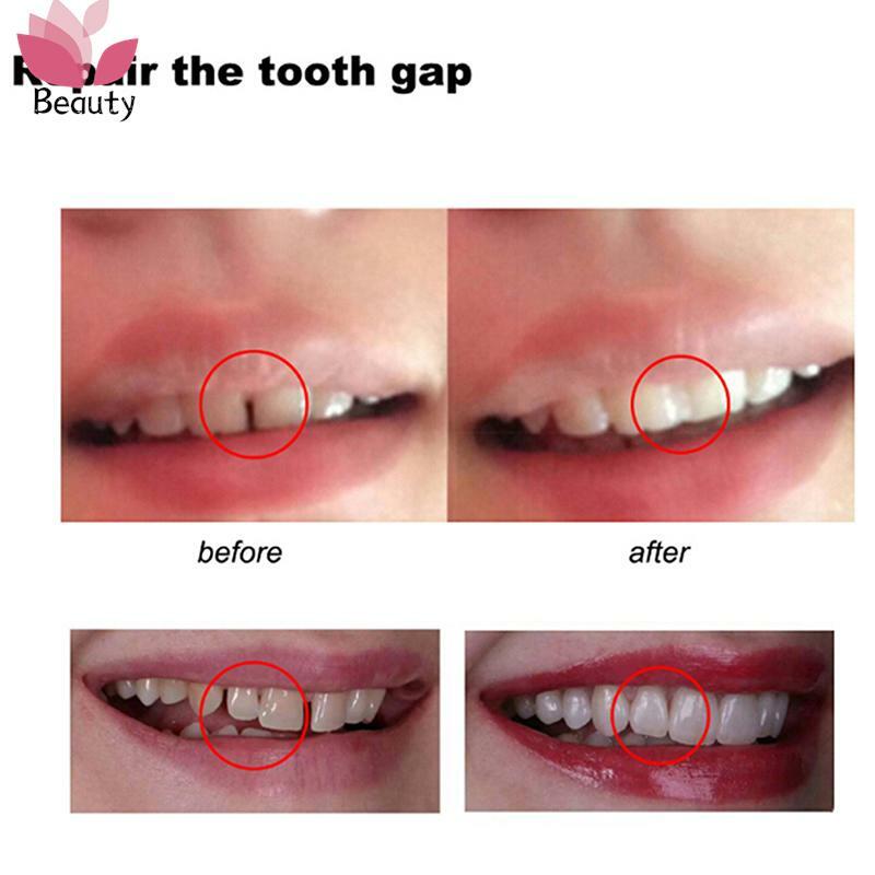Gigi palsu sementara 5-500ML, perangkat perbaikan gigi sementara dan lubang, lem Solid, perekat gigi tiruan pemutih gigi kecantikan