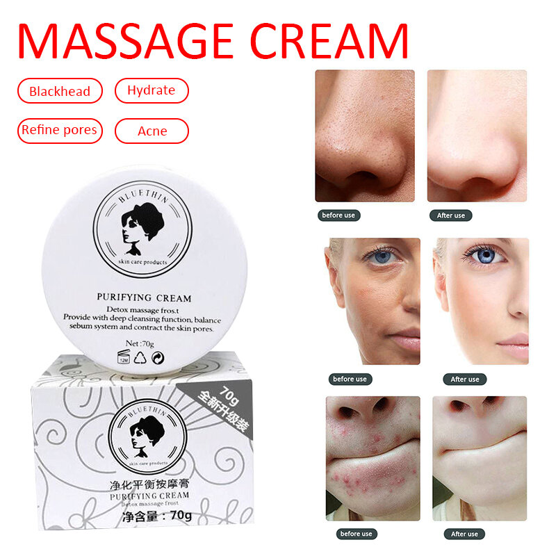 Crema purificadora de la piel Facial, cuidado de desintoxicación, blanqueamiento, limpieza profunda, manchas oscuras, brillo del acné, cuidado Facial