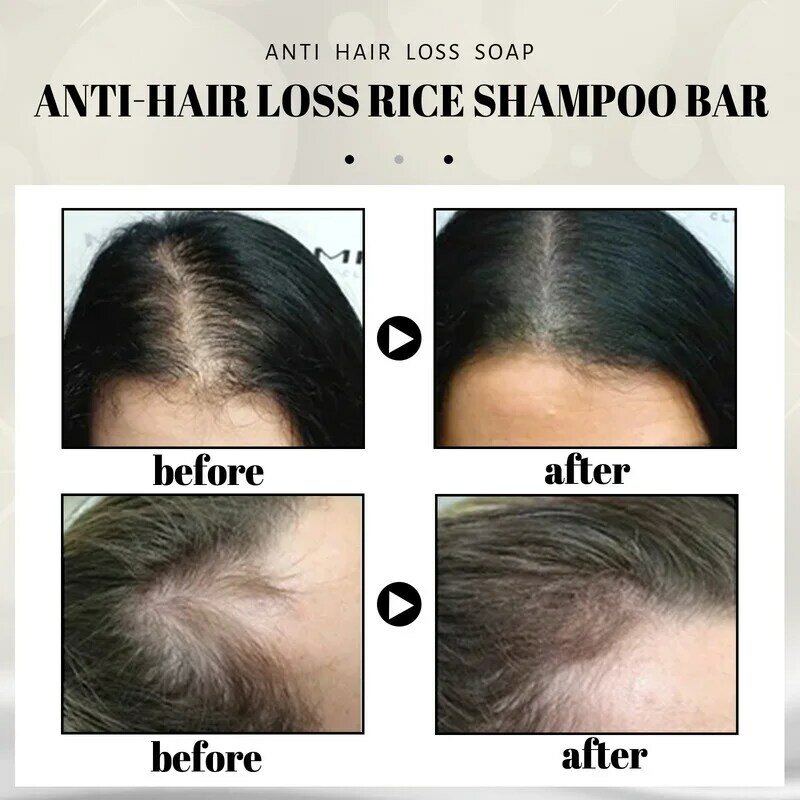EELHOE Anti-rice Shampoo Soap Hair Care Smoothing Shampoo Soap Shampoo Hair Care Soap Repair Split Shampoo Soap