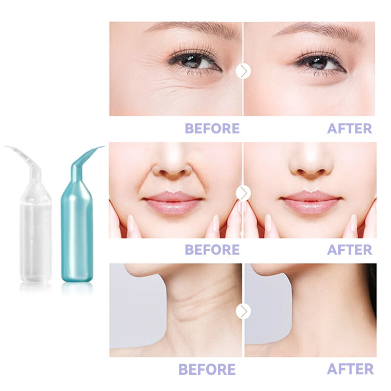 Tratamento galvânico facial spa gel hidratante reparação soro anti-envelhecimento pré-tratamento essência de cuidados com a pele ácido hialurónico