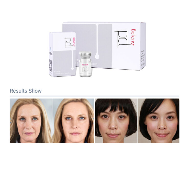 New 2022 Bellona 2ml Age Anti-Wrinkle Increase Collagen Production Face lifting
