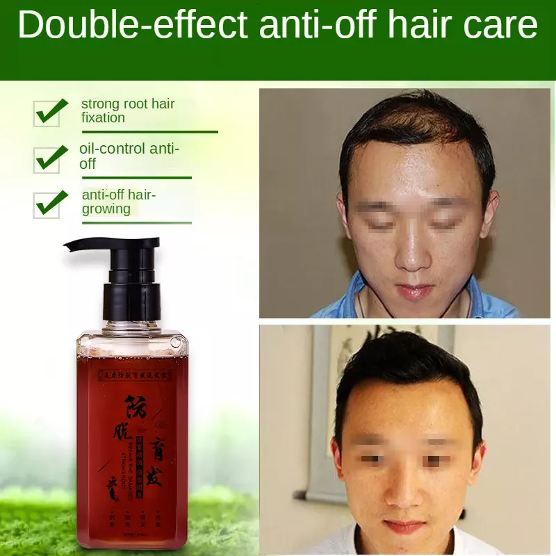 Sampo Ginseng Anti rontok untuk pria dan wanita, cairan penumbuh rambut Polygonum, perawatan penumbuh ulang rambut profesional