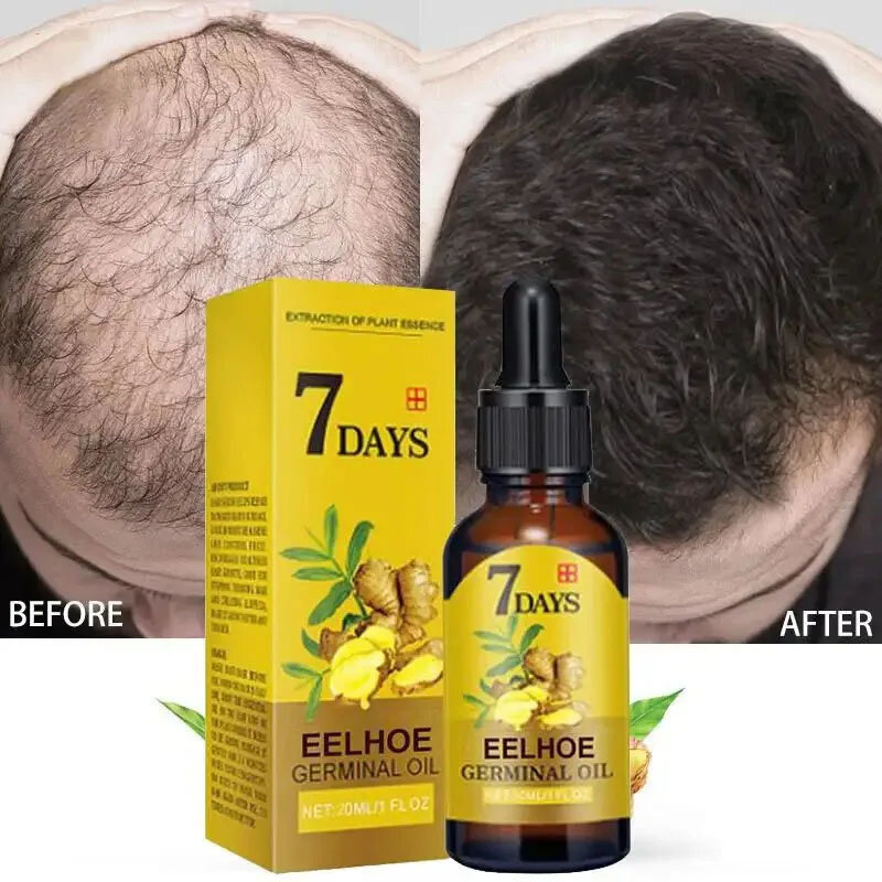 7 giorni veloce zenzero siero per la crescita dei capelli Anti-perdita ricrescita dei capelli riparazione dell'olio essenziale radici dei capelli danneggiati cura dei capelli per le donne uomini