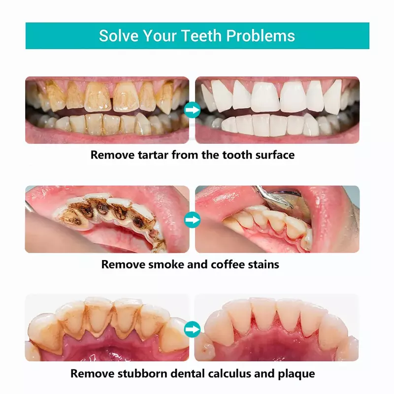Ultraschall Zahn reiniger Scaler Zähne Zahnstein Eliminator Plaque Zahnstein entferner Skalierung Entfernung Zahn reiniger