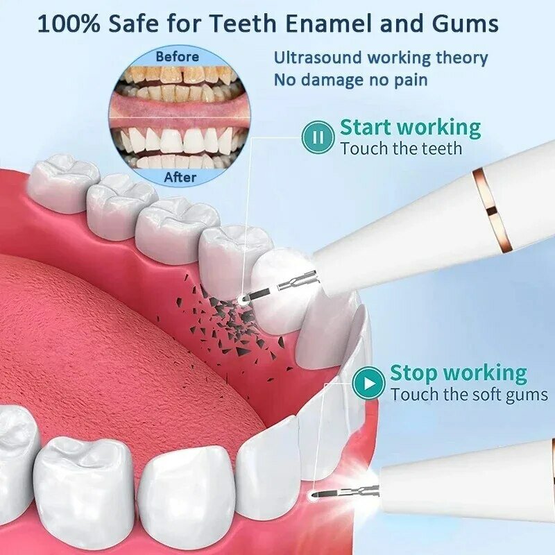 Raspador Dental eléctrico sónico, eliminador de sarro Dental Oral, limpiador de manchas de placa, blanqueamiento Dental, portátil con LED
