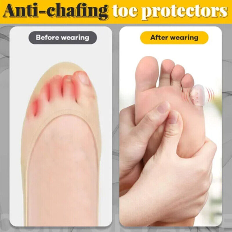 Protectores de silicona para dedos de los pies, protectores transpirables antifricción, evita ampollas, 10 piezas