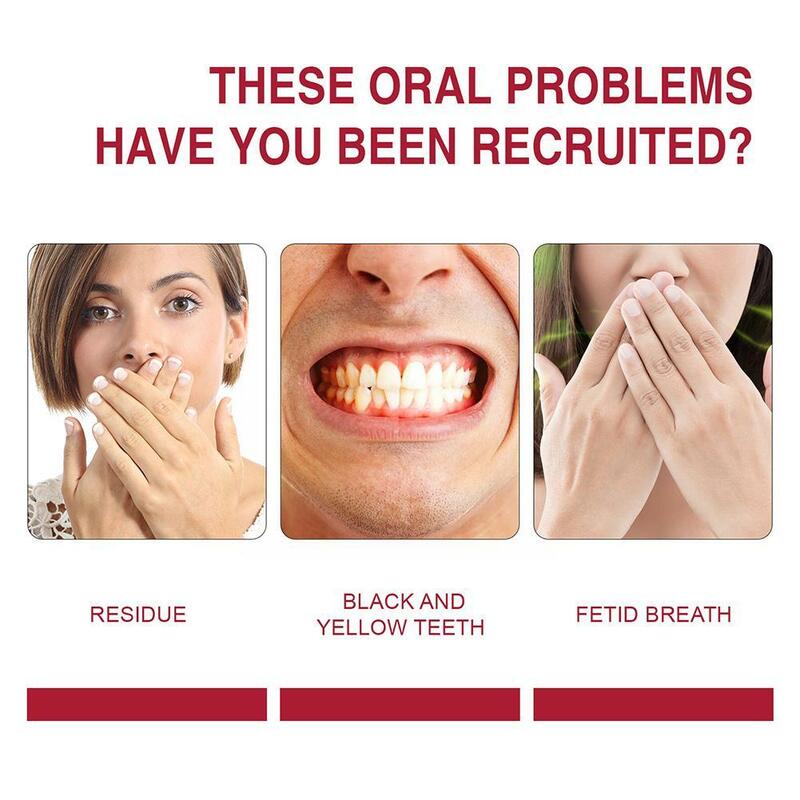 Creme Dental Clareador Probiótico, Higiene Oral, Respiração, Creme Dental Oral, Limpeza, Fresco, Previne Placa, E7B3, 30ml