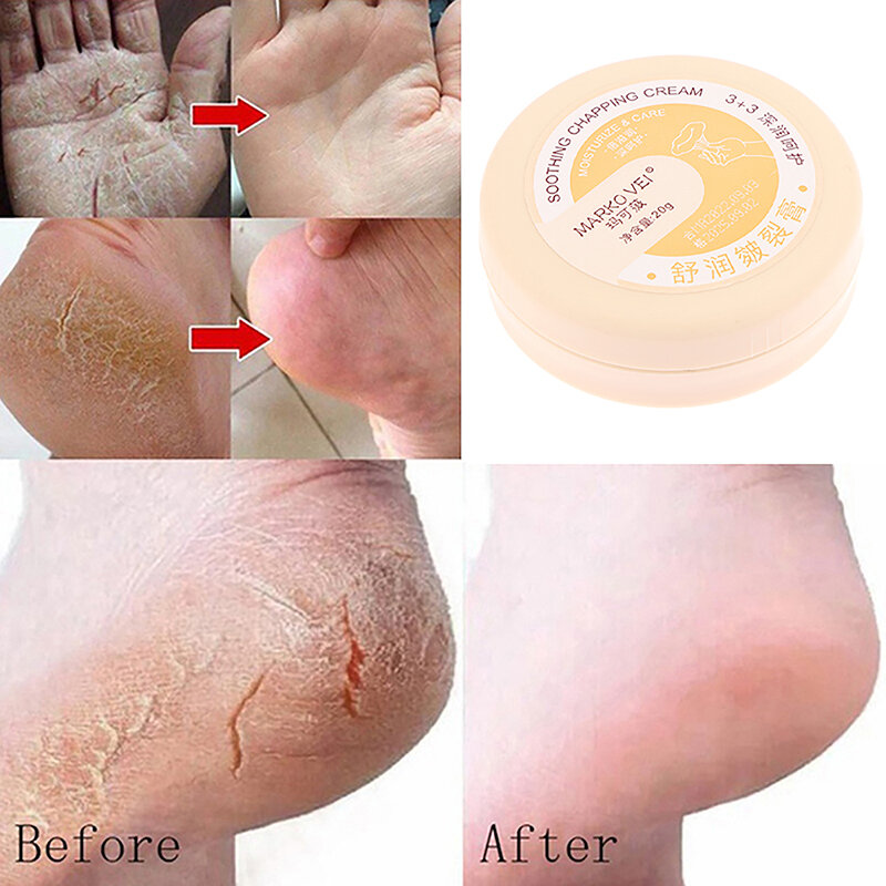 Herbal Anti Cracked Heel Treatment Cream Remoção Anti-Secagem Bálsamo de Pele Morta Calo Reparação Hidratante para Mãos e Pés Máscara de Cuidados com a Pele