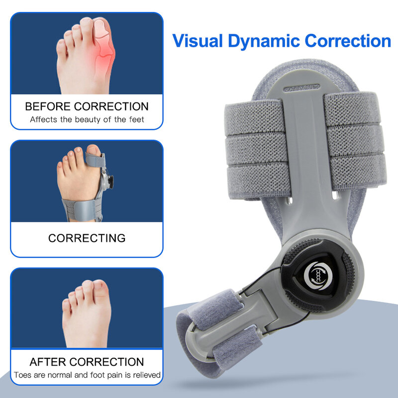 ที่รองปุ่มหัวแม่เท้ากระดูกนิ้วเท้าหมุนได้สำหรับทุกเพศอุปกรณ์ช่วยพยุงเท้าปรับได้อุปกรณ์แก้ไขนิ้วเท้า