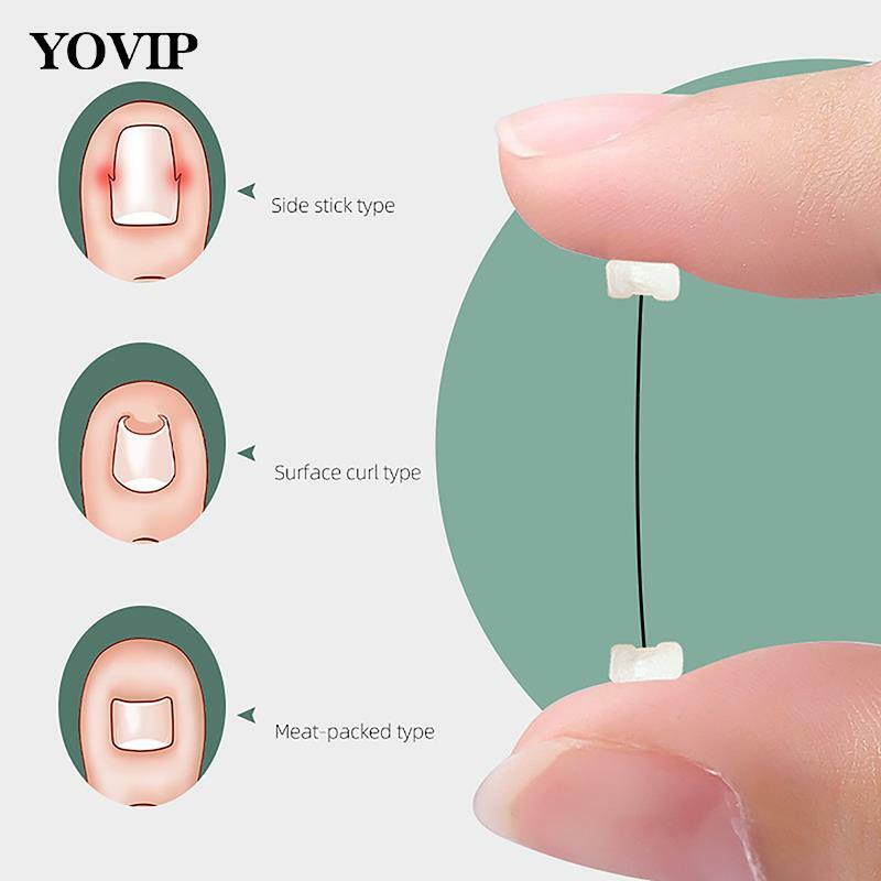 Universal Croppable Ingrown Toenail Straightening Clip Elastic Patch Toe Nails Care Corrector Patch Brace Pedicure Tools