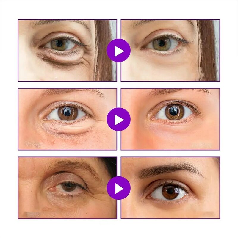 Sob o olho Patch Eye Mask, Anti-rugas Eye Patches, hidratante Hidratante, Suave Crow's Feet Care, Micro-agulha, 1 par