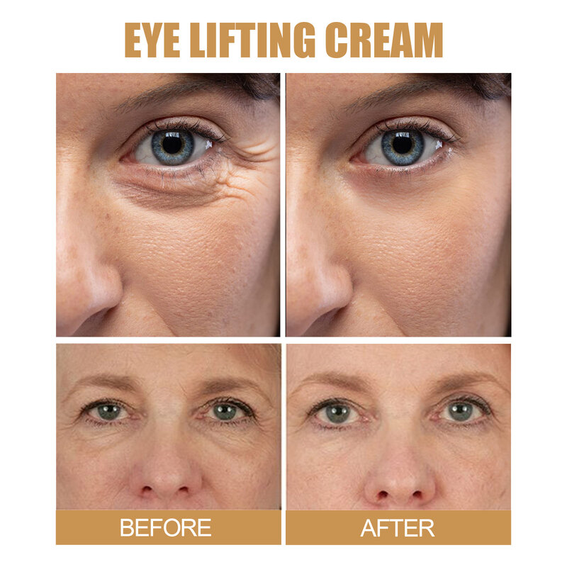 Anti Dark Circle Eye Cream Fade Fine Line Remove Eye Bags Anti Aging Moisturizing Puffiness Treatment Wrinkle Removal Eye Cream