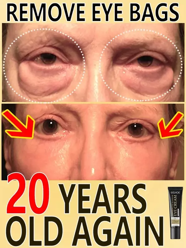 Eye Skin Care Massage Cream, Apertar Rugas, Remover Bolsas Olho, Inchar, Levantar, Refirmar, Suave, Nutriir, Remover Bolsas Olho, 7 Dias