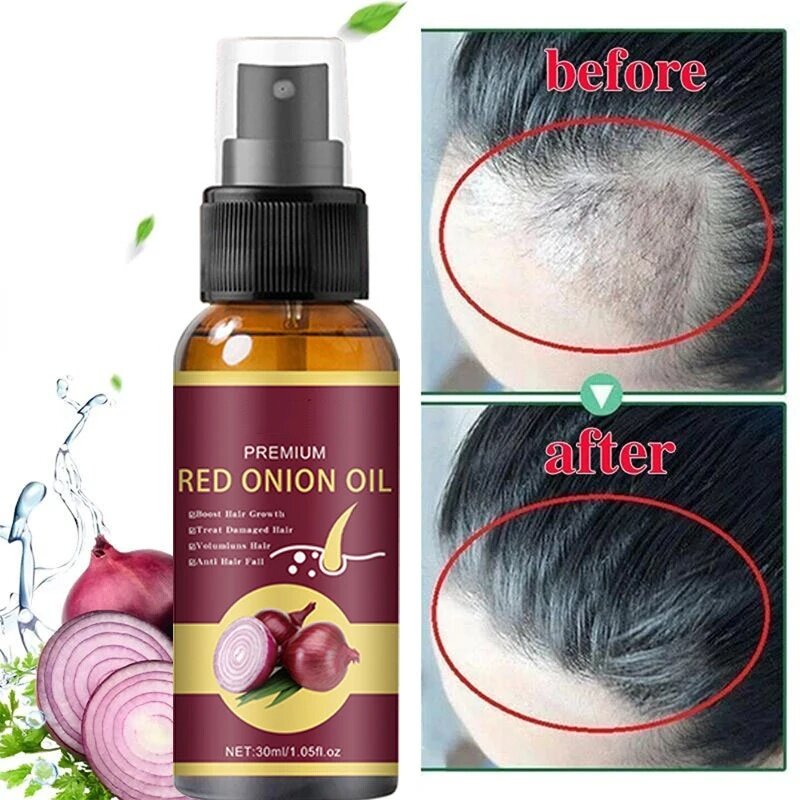 Powerful Hair Growth Serum Spray Repair Hair Nourish Root Regrowth Hair Anti Hair Loss Treatment Essence For Men Women Hair Care
