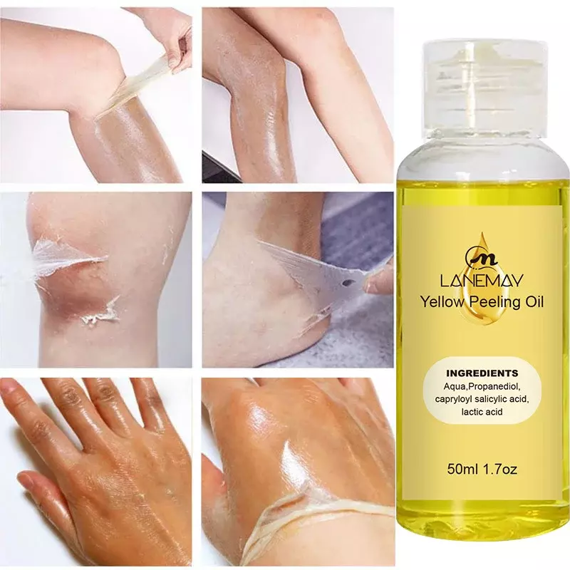 Yellow Peeling Oil Dark Skin Remove Arm Knee Legs Melanin Whiten Serum Body Brighten Scrub Exfoliating Dead korean Skin Care