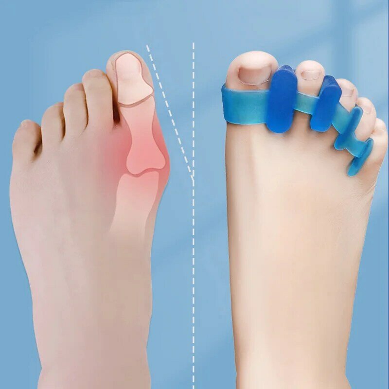 Separador de dedo do pé hallux valgus corrector joanetes separador de dedo do pé corrector dedos dos pés haluksy toe espalhador joanete corrector