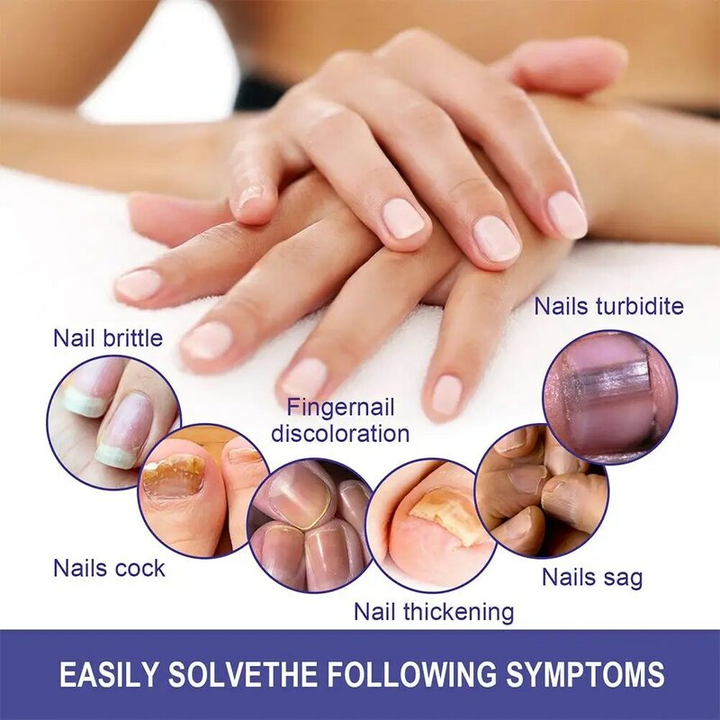 指と爪の修理のためのクラゲ治療,爪の修復,爪の真菌症,抗感染,指の真菌除去,i7d6