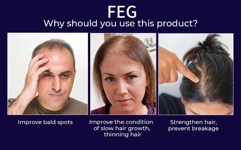 Feg Hair Revitalizing Spray, Adequado para cabelos saudáveis, 50 ml