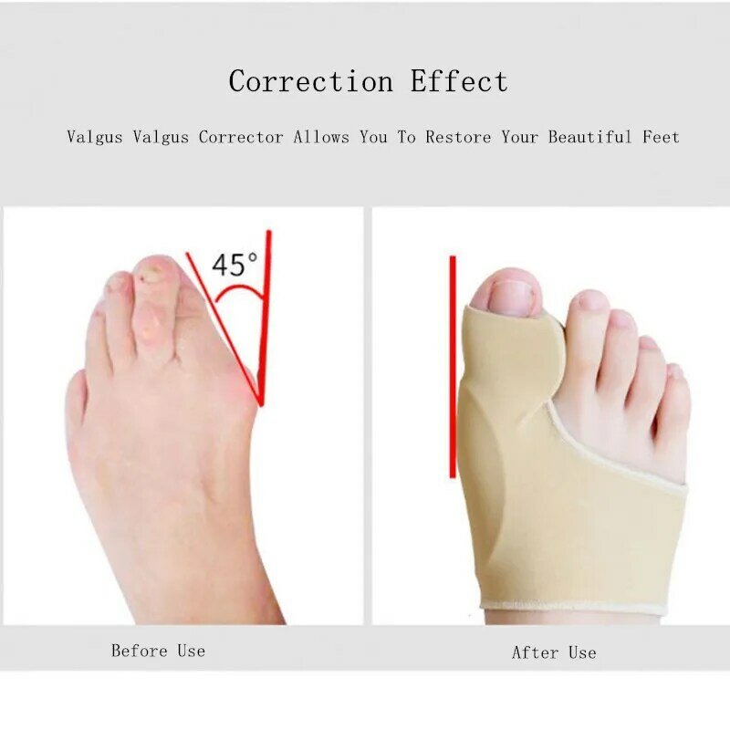 Adjuster Toe Corrector Straightener Soft Silicone Pedicure Socks Bunion Toe Separator Orthotics Hallux Valgus Bunion Corrector