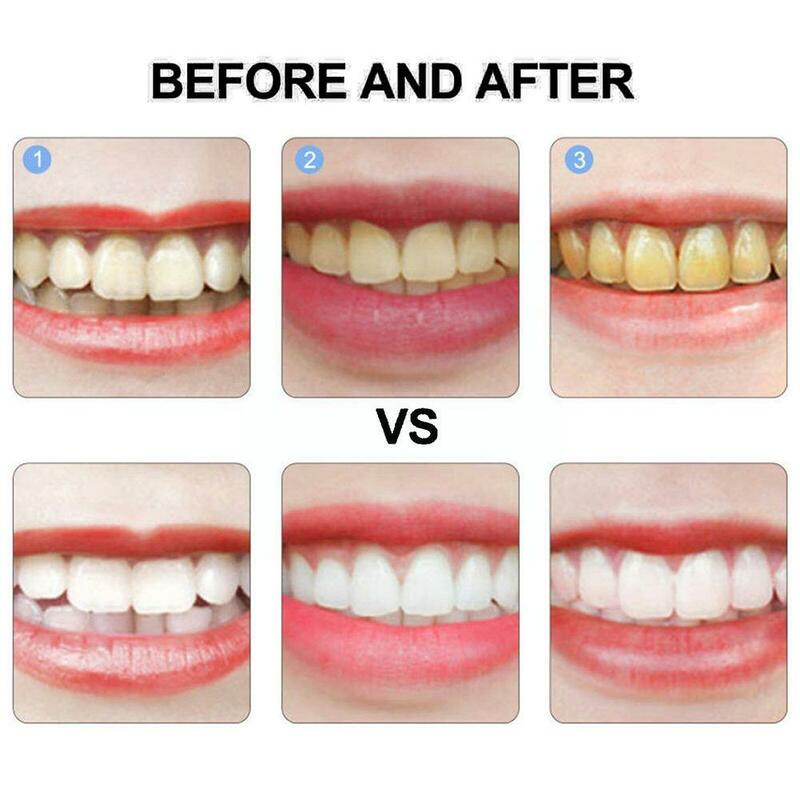 100g pemutih perbaikan cepat gigi, penghilang plak gigi kuning memutihkan noda perbaikan kerusakan