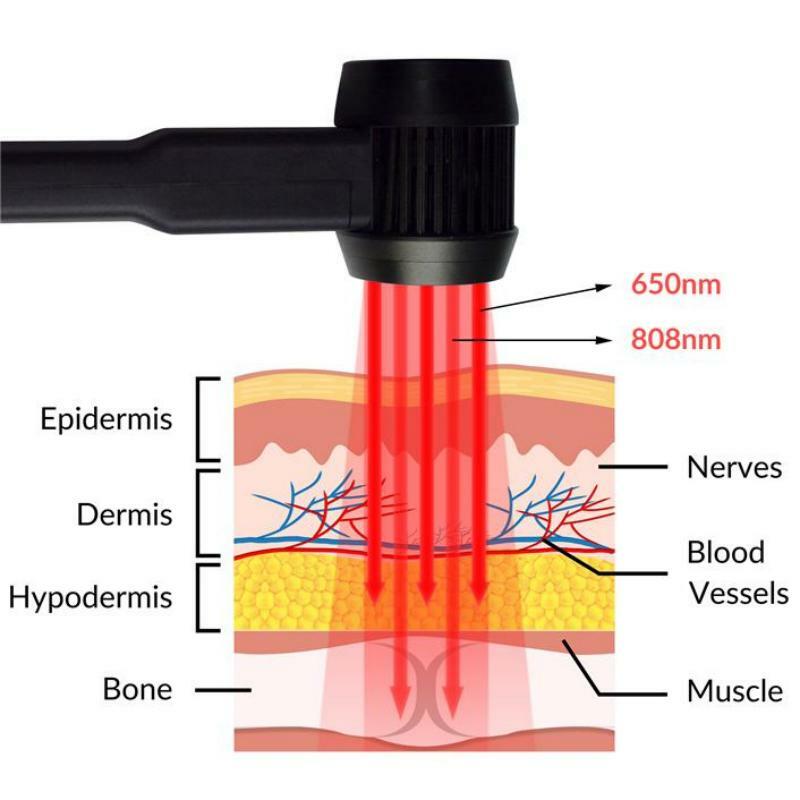 ZJZK-Terapia a laser de tecido macio em casa, Laser frio para dor no joelho, tensão muscular, degeneração do disco traseiro baixo, 650nm, 808nm