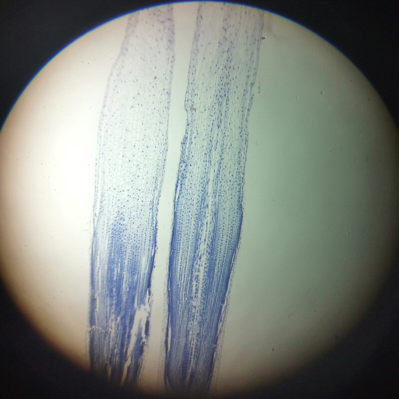 Mitosis-microscopio con toboganes de vidrio, 12 piezas, 5 piezas, punta de raíz de cebolla