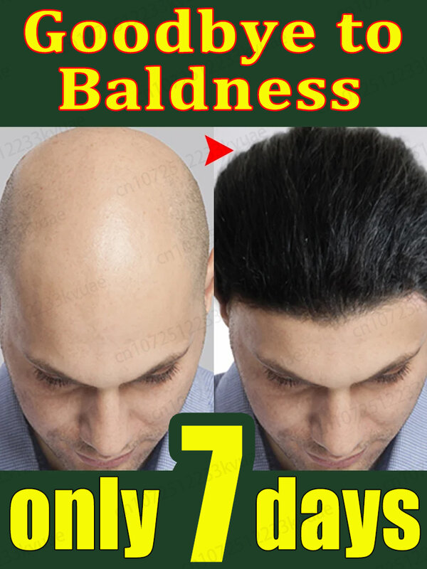 Aceite para el crecimiento del cabello, reparación eficaz de la calvicie, caída del cabello hereditaria, caída del cabello posparto