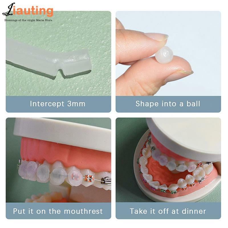 Dental Orthodontic Wax Relief Sticks para aparelhos, Bracket Gum Irritação, Ferramenta de Higiene Oral, Dentes Whitening Materiais, Cera Relief, 5pcs por caixa