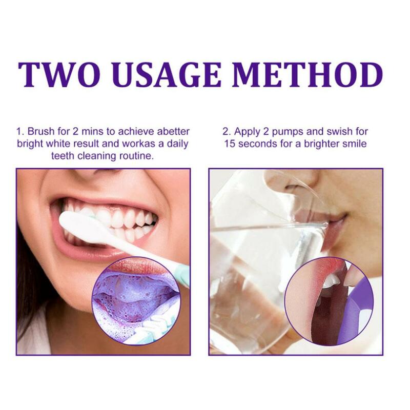 Mousse pemutih gigi, efektif menghilangkan plak kuning noda asap membersihkan gigi segar