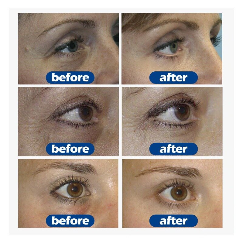 Collagen Anti-Wrinkle Eye Cream Fade Fine Lines Dark Circles Serum Remove Eye Bags Puffiness Anti-Aging Cream Firming Eye Care