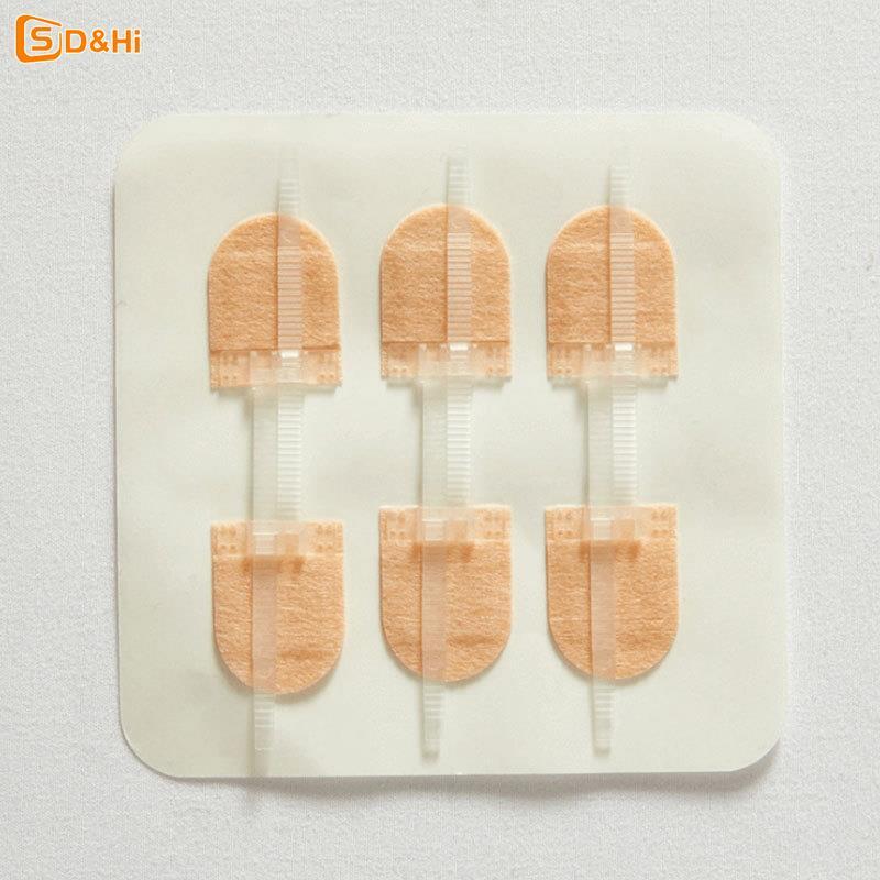 Band-Aid Zipper Tie Wound Closure Patch Hemostatic Patch Wound Fast Suture Zipper Band-Aid Outdoor Portable