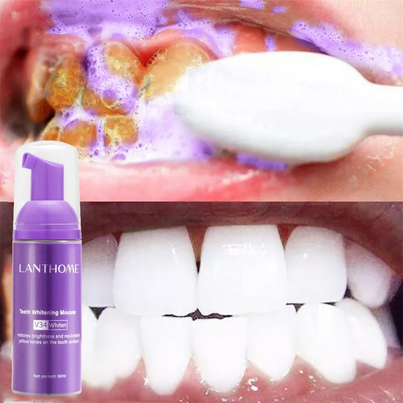 1ชิ้นที่ทำความสะอาดฟัน V34มูสยาสีฟันทำความสะอาดคราบบุหรี่สีขาวซ่อมแซมคราบจุลินทรีย์ทันตกรรมผลิตภัณฑ์ทำความสะอาดฟัน