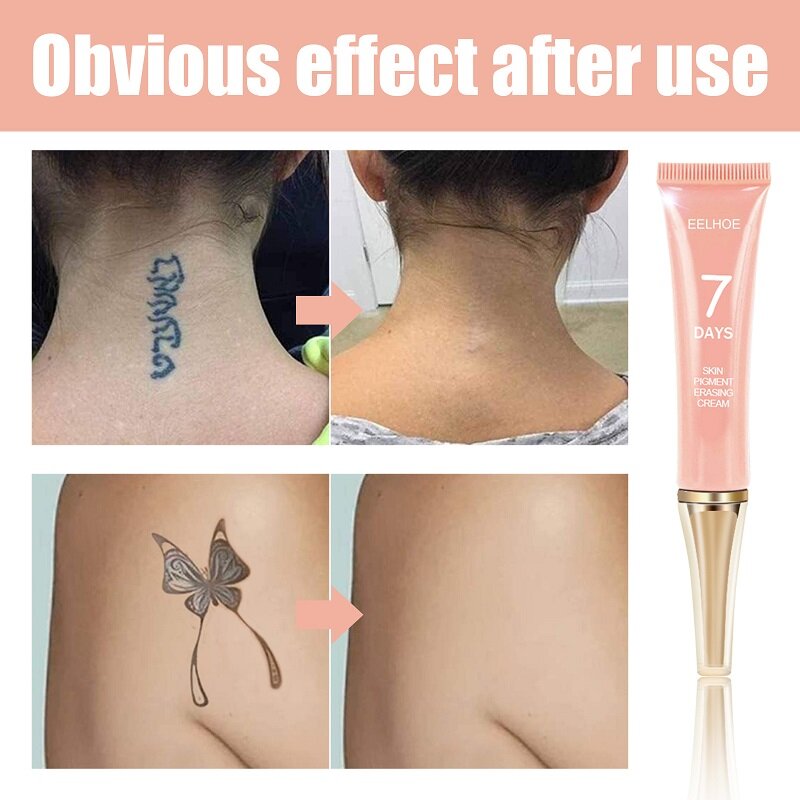 7 Days Permanent Tattoo Removal Cream Skin Tattoos Remover Gel Painless Scarless Removal Maximum Strength Body Tattoo Cleaning