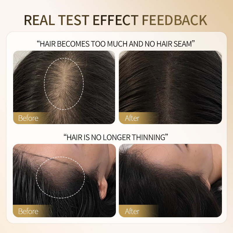 Borala Hair Scalp Herbal Nutrient Solution For Hair Scalp Tattoo Care Repairing Scalp Hair Growth Treatment Scalp Beauty Art