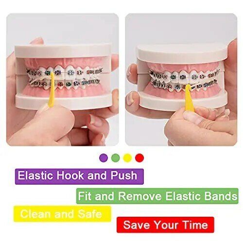 Bandas de goma elásticas para ortodoncia, herramienta de plástico desechable, paquete de 20